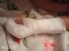 Mana meita salauza kreisās rokas pirkstu